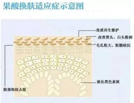 “刷酸”护肤，美丽不打烊